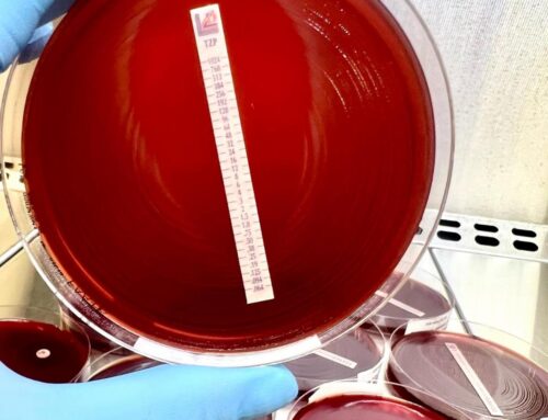 FAA-HB  Fastidious Anaerobe Agar w/ Horse Blood